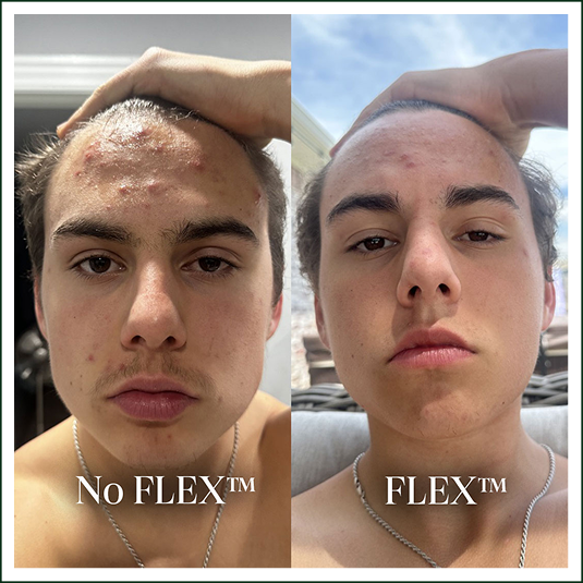 Vakage™ Face Brush